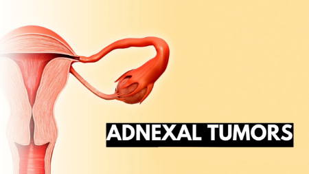 توده آدنکسال, سونوگرافی توده آدنکسال