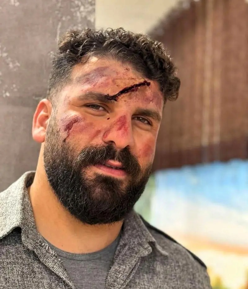 حادثهی تلخ برای بلاگر معروف اینستاگرامی / سقوط «وضعتان چونه» در کوهستان حادثهی تلخ برای بلاگر معروف اینستاگرامی / سقوط «وضعتان چونه» در کوهستان