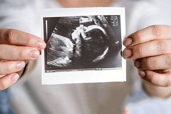 حمایت روانی، مهمترین عامل تداوم بارداری است