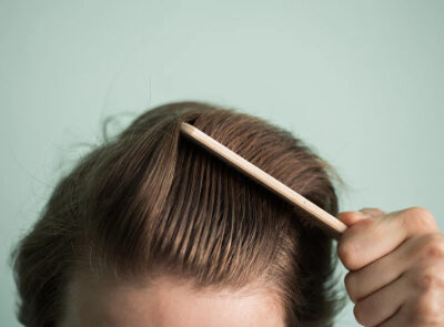 رشد سریع مو در ۳۰ روز: راهنمای کامل و علمی با ۵ نکته طلایی