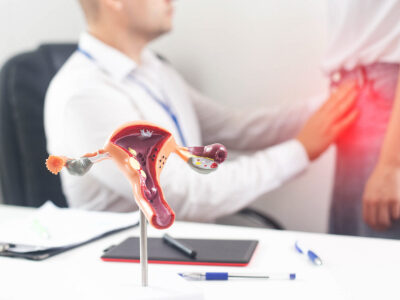 فیبروم‌های رحمی؛ راه‌های طبیعی و پزشکی برای کوچک کردن و مدیریت آن‌ها