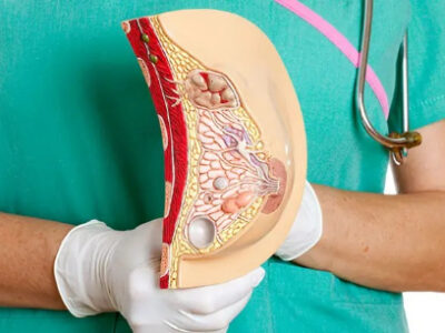 لکه‌های سفید روی سینه؛ نشانه چیست و چه باید کرد؟