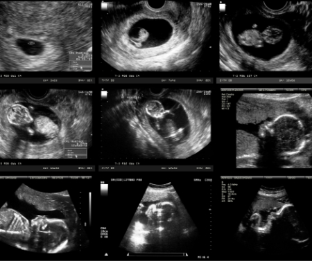 رشد جنین در بارداری
