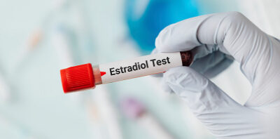 همه چیز در مورد آزمایش استرادیول (estradiol)