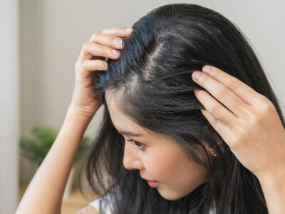 هورمون‌ها و ریزش مو: آیا مشکل از درون بدن است؟