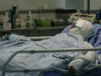 ۸۵ درصد سوختگی‌ها با روش‌های ساده قابل پیشگیری است