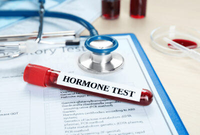 آزمایش هورمون زنانه: رازهایی که بدنتان از شما پنهان کرده!