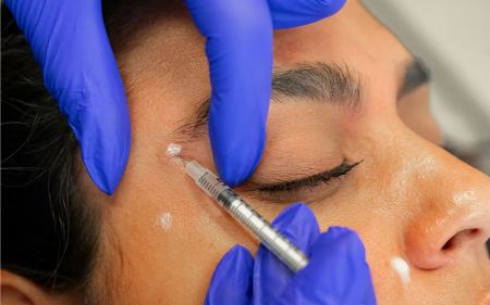 تزریق فیلر تزریق فیلر