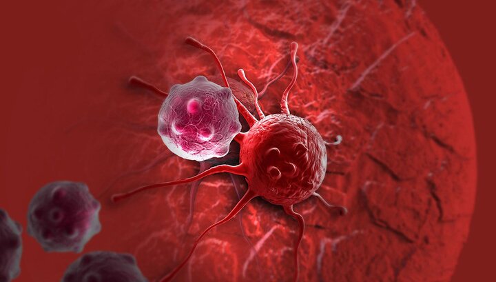 افزایش نگرانکننده سرطان روده بزرگ در ایران افزایش نگرانکننده سرطان روده بزرگ در ایران