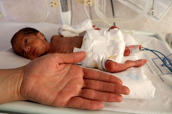 ترخیص نوزاد ۷۰۰ گرمی پس از ۴۸ روز تلاش شبانهروزی کادر درمان