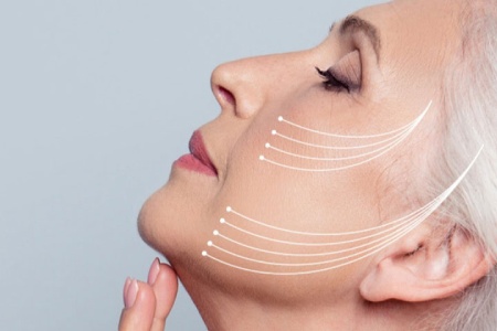 لیفت صورت بعد از 50 سالگی لیفت صورت بعد از 50 سالگی