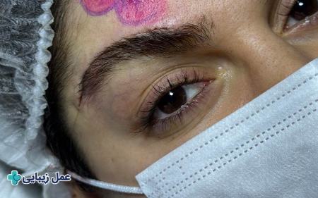 عمل زیبایی عمل زیبایی