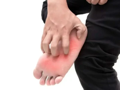 خارش کف پا؛ مشکل کوچک یا نشانه بیماری جدی؟