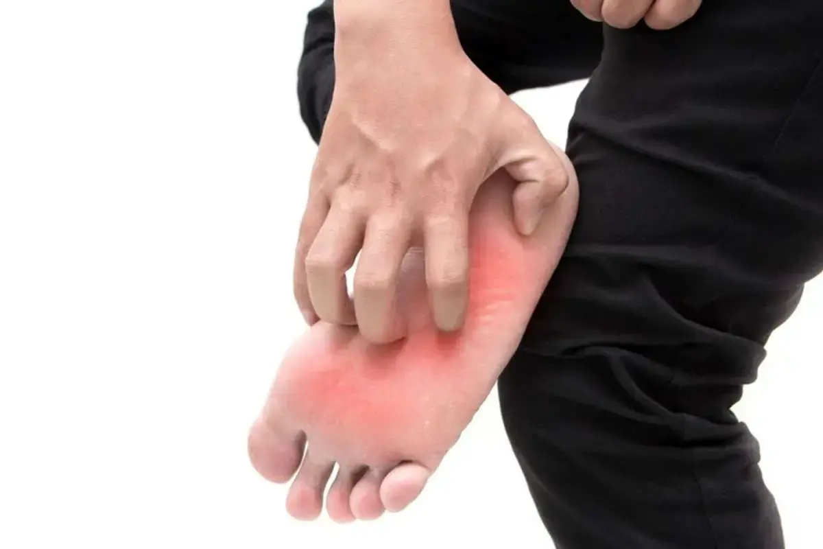 خارش کف پا؛ مشکل کوچک یا نشانه بیماری جدی؟