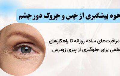راهنمای جامع پیشگیری از چین و چروک دور چشم