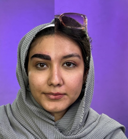 نتیجه نهایی کاشت ابرو