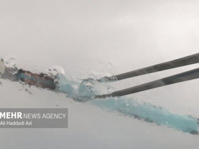 فریز جنین چیست و برای چه کسانی توصیه می‌شود؟