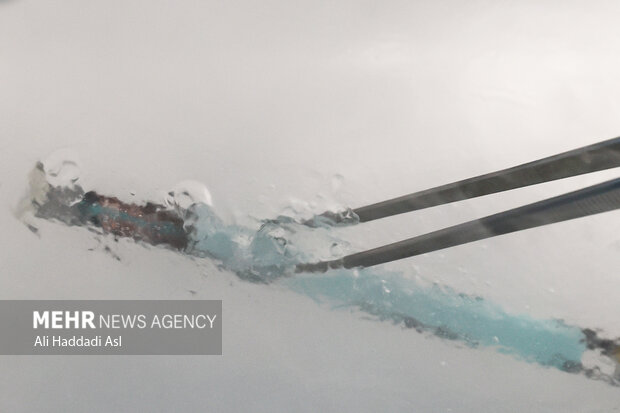 فریز جنین چیست و برای چه کسانی توصیه میشود؟