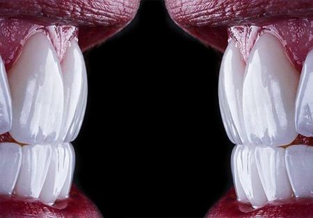 جایگزینهای مناسب؛ اگر لمینت برای من مناسب نیست، چه کنم؟ جایگزینهای مناسب؛ اگر لمینت برای من مناسب نیست، چه کنم؟