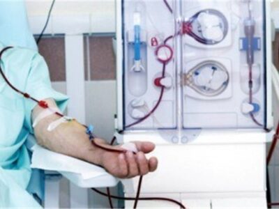 پرتودهی هسته‌ای 1.3 میلیون فیلتر دیالیز بدون هیچ‌گونه عارضه