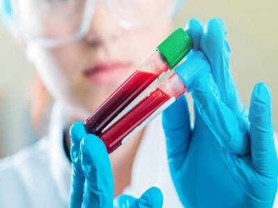 چقدر احتمال دارد مبتلا به سرطان شویم