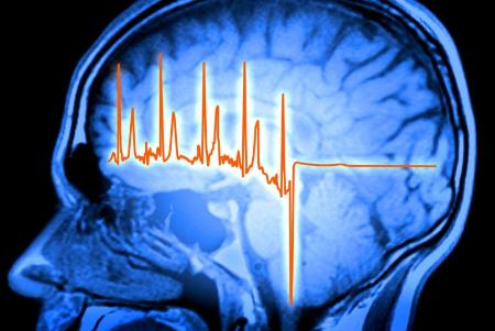 مغز،اخبار پزشکی،خبرهای پزشکی مغز،اخبار پزشکی،خبرهای پزشکی