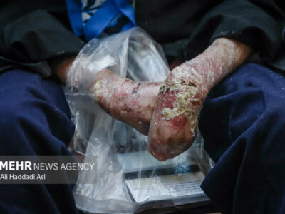 ارسال ۱۰۰۰ دارو و ۹۷۰ پانسمان بیماران پروانه ای