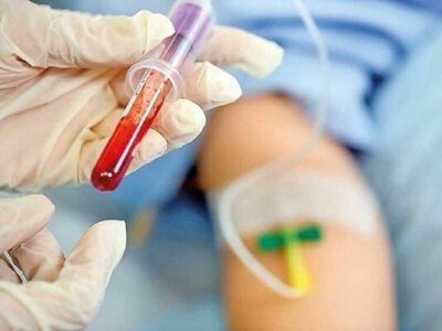 بیماری هموفیلی؛ از ابتلا تا پیشگیری