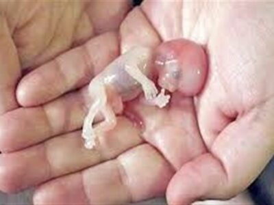 صدور کیفرخواست برای 9 متهم پرونده سقط جنین غیرقانونی در گلستان