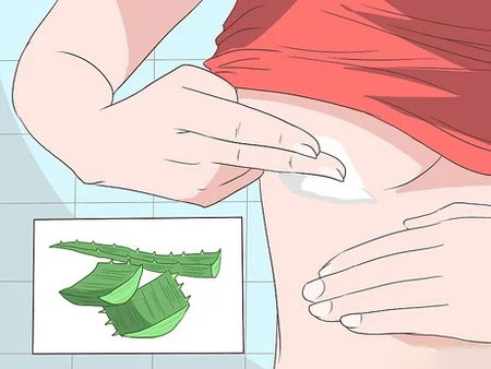عرق سوز شدن سینه ها, علت عرق سوز شدن بین سینه ها, درمان عرق سوز شدن بین سینه ها