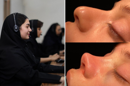 مراحل عمل بینی با پزشک 24 چگونه است؟