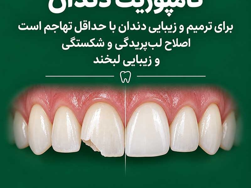 ایمپلنت، کامپوزیت یا لمینت، هر کدام برای چه مشکلی مناسب هستند؟