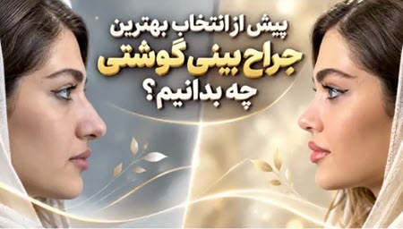 مقایسه قبل و بعد جراحی بینی گوشتی و اهمیت انتخاب بهترین جراح بینی گوشتی  برای رسیدن به نتیجه طبیعی و متناسب با چهره