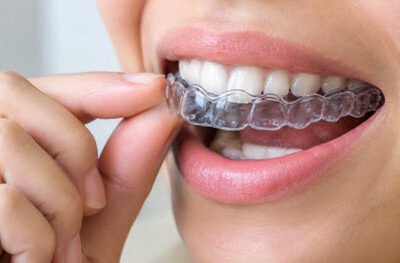 تفاوت ارتودنسی ثابت و متحرک