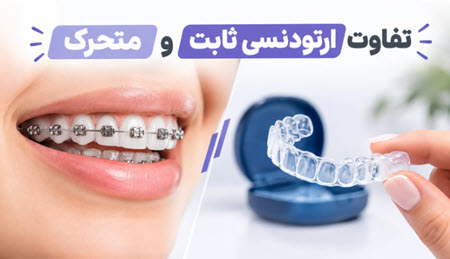 فرق ارتودنسی ثابت و ارتودنسی متحرک چیست؟