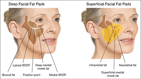 KEYWORDS