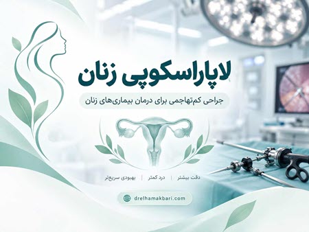 لاپاراسکوپی زنان