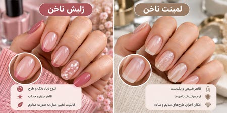 تفاوت لمینت و ژلیش از نظر ظاهر